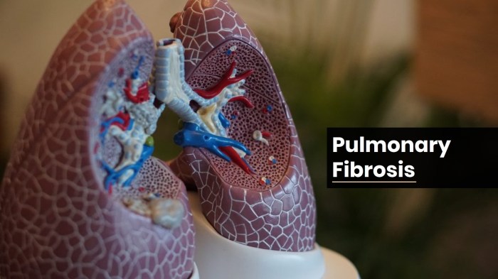 Symptoms of lung fibrosis